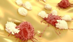 Lymphocytes attacking cancer cells 
