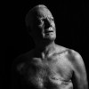 Jose Ferreira, male breast cancer