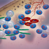 Multiple myeloma cells