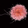 Colorized scanning electron micrograph of a natural killer cell from a human donor