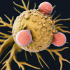 T cells attack a cancer cell
