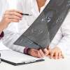 Evaluation of brain MRI scan