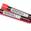 Hepatitis C Hepatitis B blood test tubes