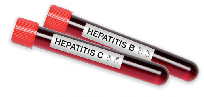 Hepatitis C Hepatitis B blood test tubes
