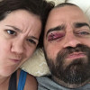 Whitney and Adam, post-seizure run-in with the dining table
