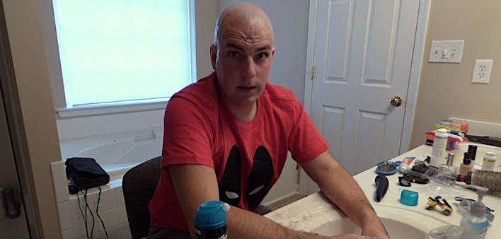 testicular cancer, chemotherapy, side effects, hair loss, bald