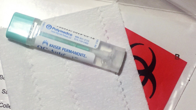 FIT test, colon cancer screening