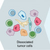 General experimental workflow for single-cell RNA sequencing of human tumors
