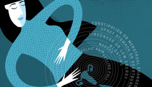 ovarian cancer