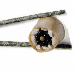 Were HIVers paying an extra $5 for their meds so that I could eat California rolls?