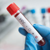 vial of blood marked as HIV positive