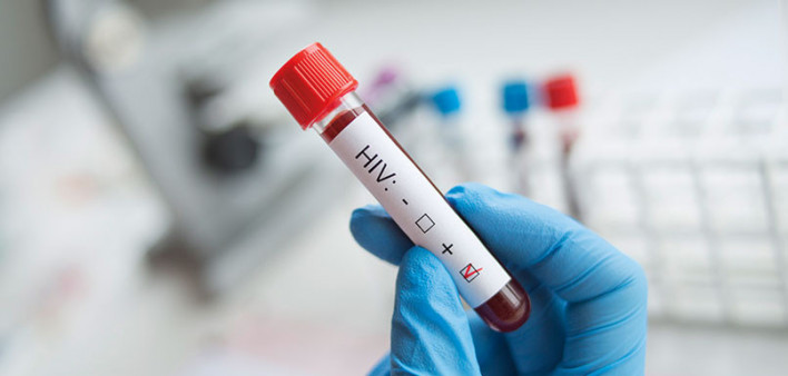 vial of blood marked as HIV positive