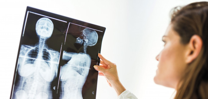 doctor looking at x ray