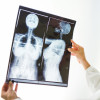 doctor looking at x ray