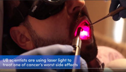 UB scientists use light to treat a painful side effect of cancer