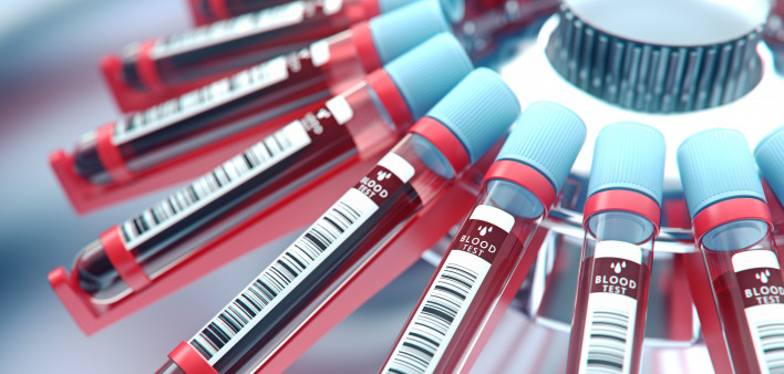 Lab equipment centrifuging blood