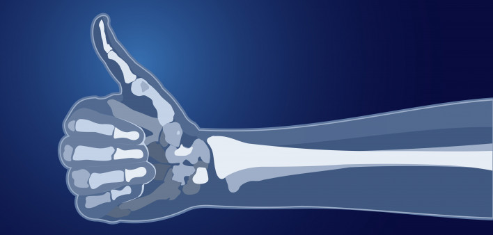  bones skeleton x-ray