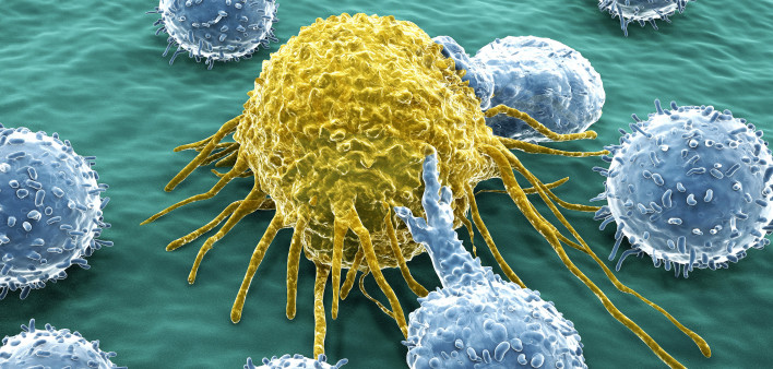 Lymphocytes attacking a cancer cell