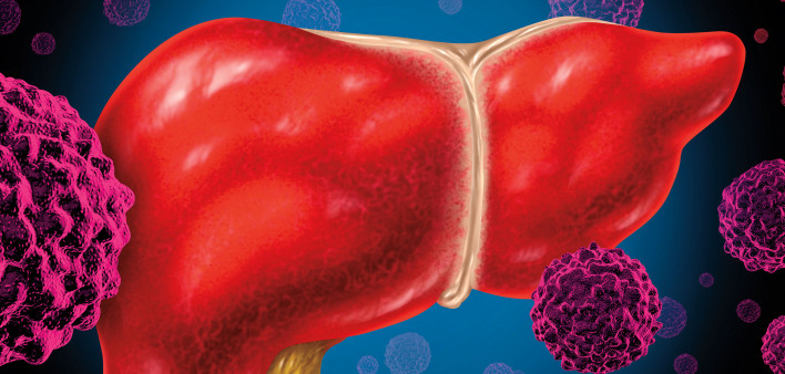 human liver cancer cells