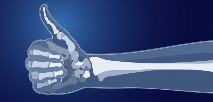  bones skeleton x-ray