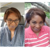 Curly vs. straight post-cancer