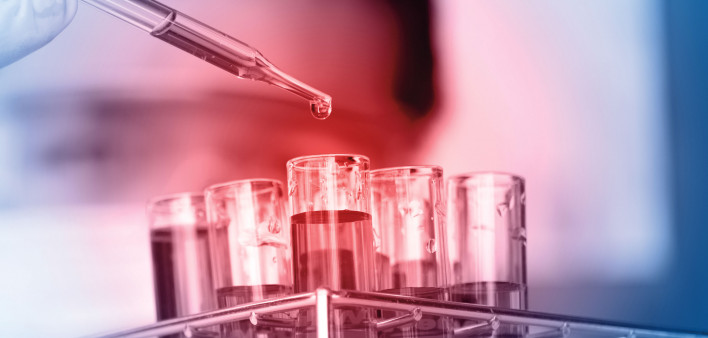 test tubes in lab eye dropper