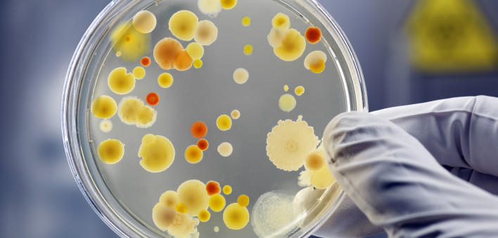 Gloved Hand Holding Petri Dish with Bacteria Culture