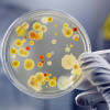 Bacteria in a petri dish