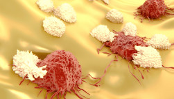 Lymphocytes attacking cancer cells 
