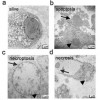 A live cell (a) and cells undergoing apoptosis, where cells shrink as they die (b); necroptosis, where a cell swells before bursting (c); and necrosis, where a cell and its organelles are ruptured (d)