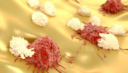 Lymphocytes attacking cancer cells 