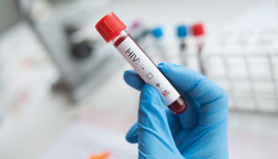 vial of blood marked as HIV positive