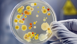 Gloved Hand Holding Petri Dish with Bacteria Culture