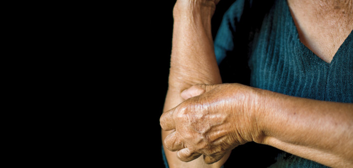 older woman's hand scratching her arm