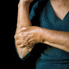 older woman's hand scratching her arm