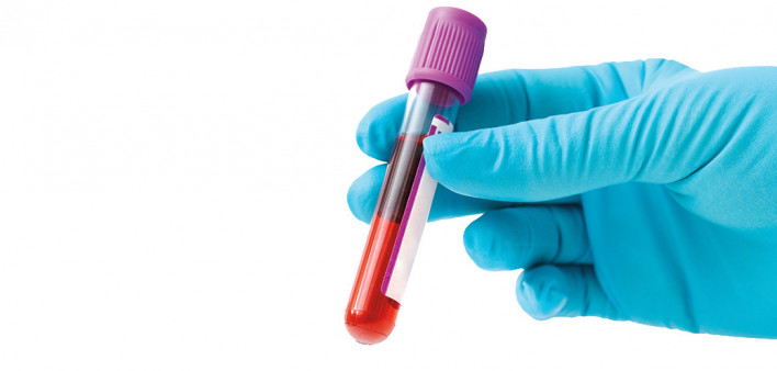 blue gloved hands holding blood vial