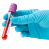 blue gloved hands holding blood vial