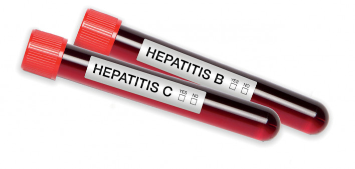 Hepatitis C Hepatitis B blood test tubes