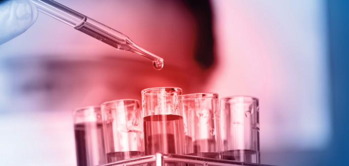 test tubes in lab eye dropper