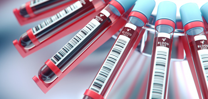 Lab equipment centrifuging blood
