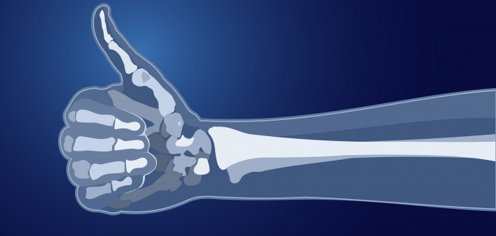  bones skeleton x-ray