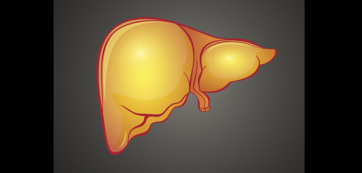 fatty liver