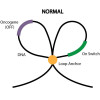 In normal cells, a loop anchor separates an oncogene from a nearby “on switch.” In SDH-deficient GIST, the anchor is lost and the switch turns the oncogene on.