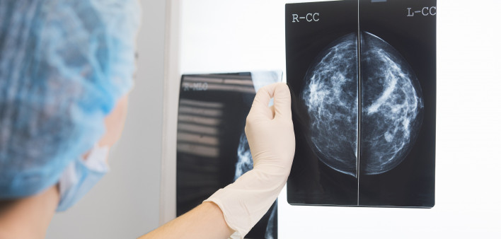 Mammogram image