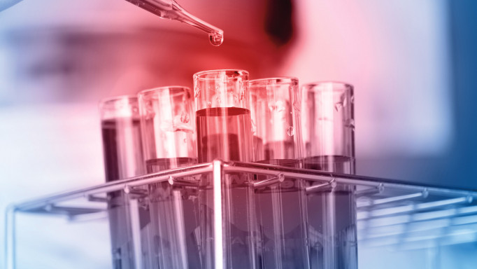 test tubes in lab eye dropper