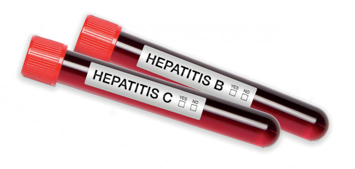 Hepatitis C Hepatitis B blood test tubes