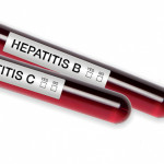 Hepatitis C Hepatitis B blood test tubes