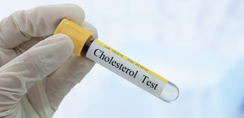 test tube with Cholesterol Test written