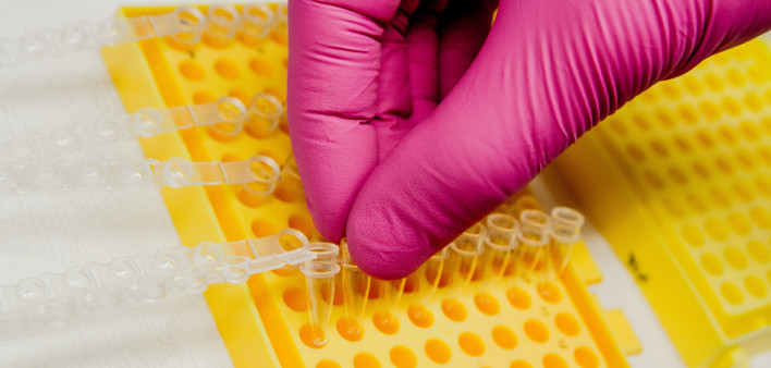 genetic testing
