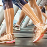 woman on treadmil with illustration of her bones
